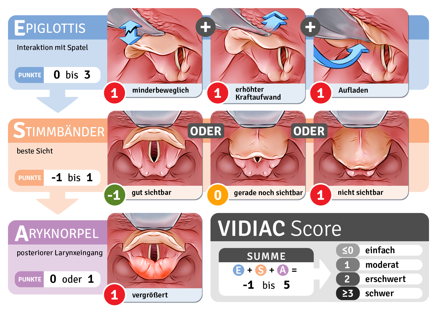 Spezielle Manöver und Techniken bei erschwerter Videolaryngoskopie